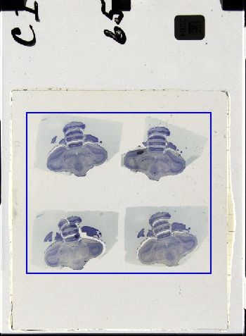 Media type: image; Special Collections 3298   shows specimen_part histological serial section;